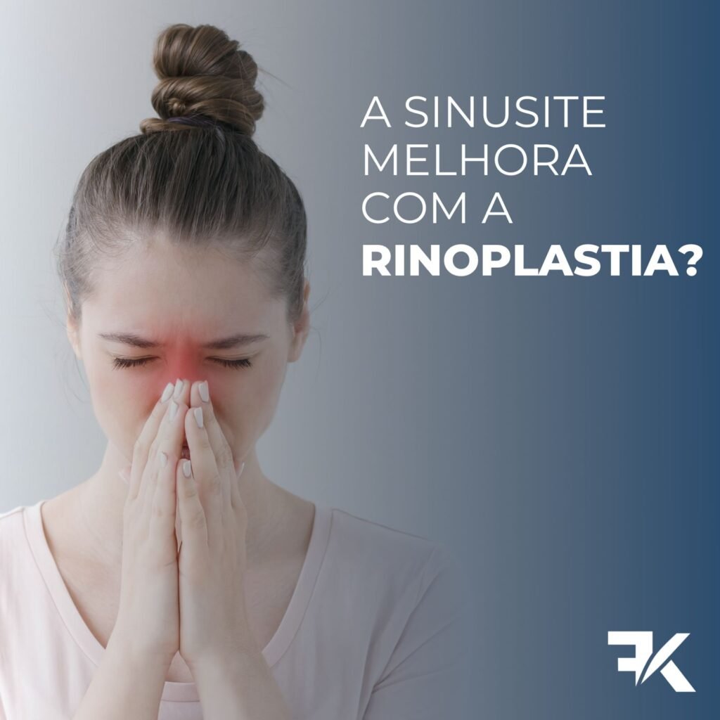 A Sinusite Melhora com a Rinoplastia?