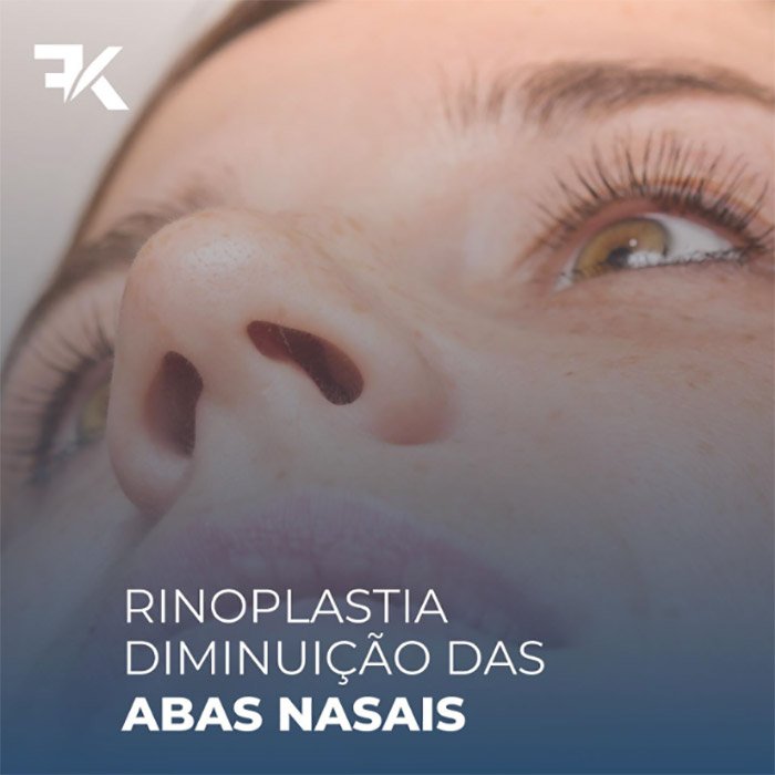 Rinoplastia – Redução das abas nasais