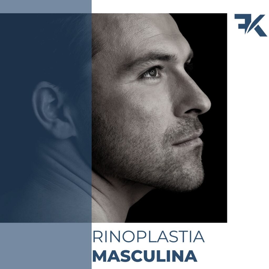 Rinoplastia Masculina