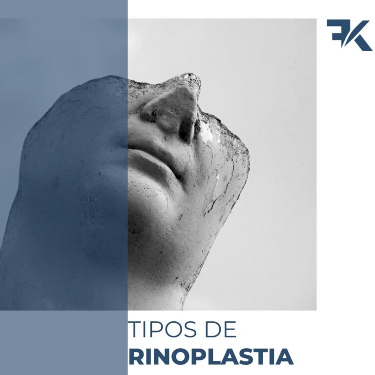 Tipos de Rinoplastia