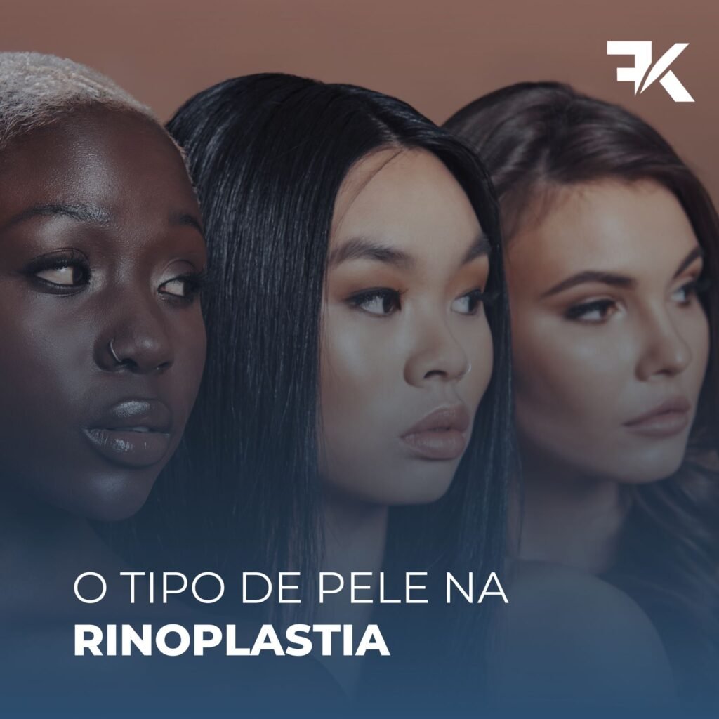 O tipo de pele na Rinoplastia