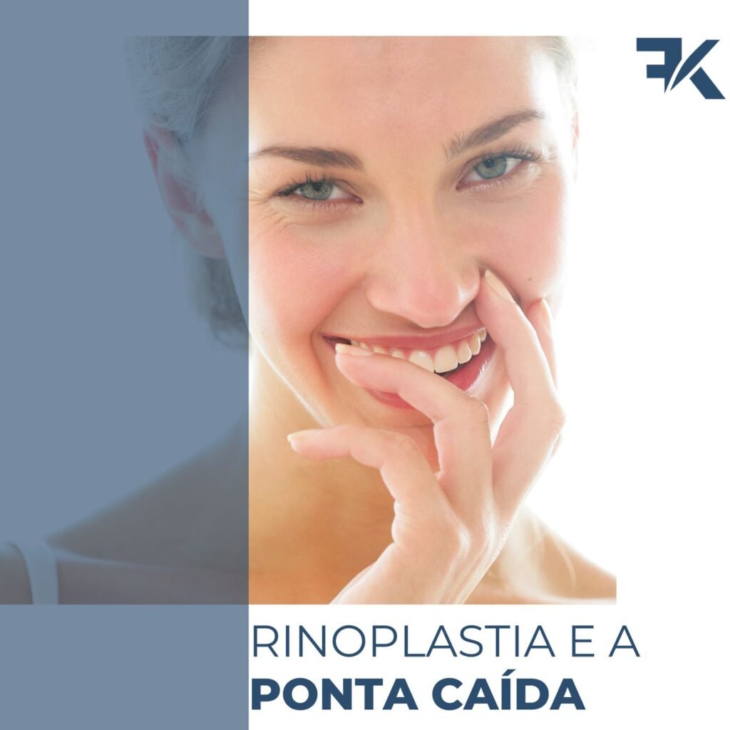 Rinoplastia e a ponta caída