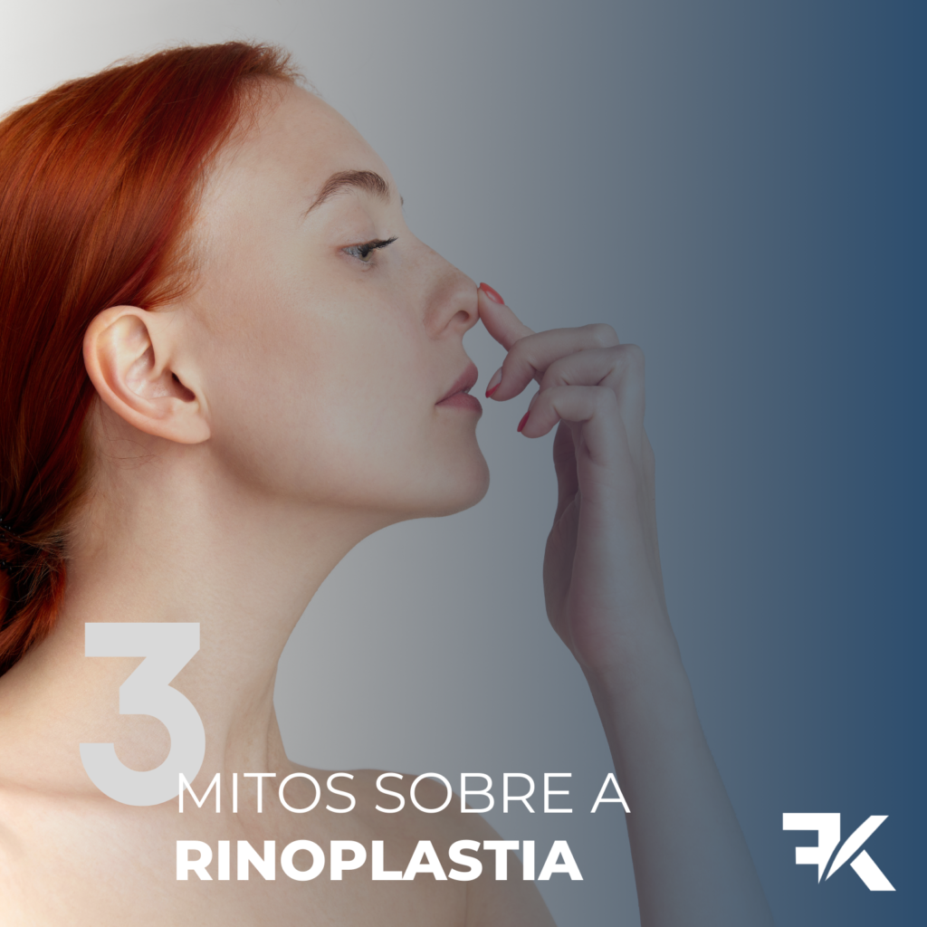 3 Mitos sobre a Rinoplastia