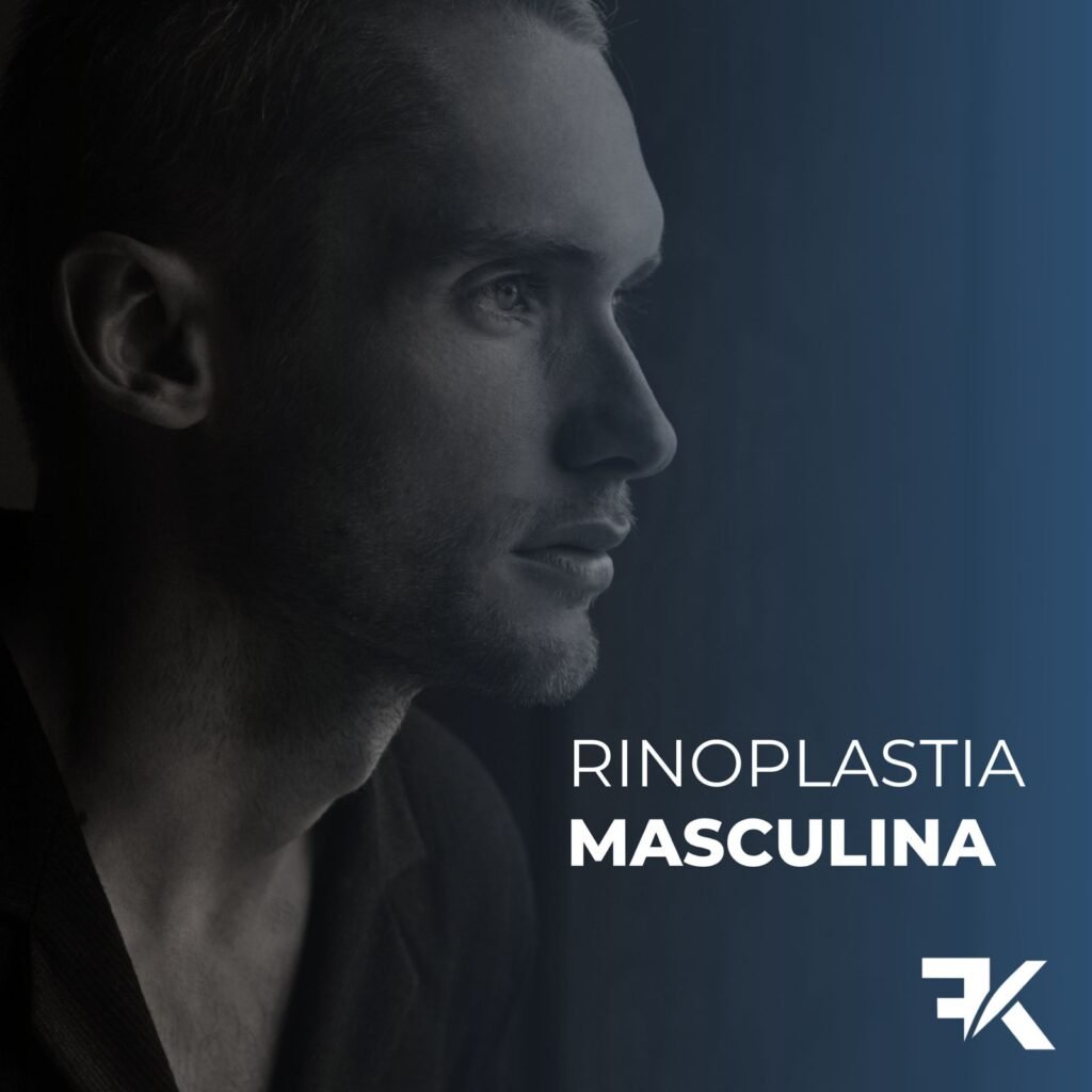 Rinoplastia Masculina